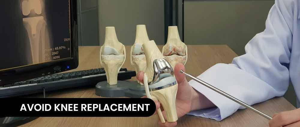 5-tips-to-avoid-knee-replacement